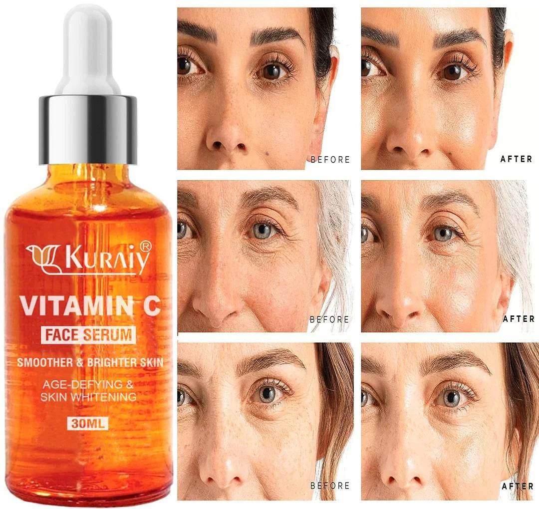 Kuraiy Best Vitamin C Brightening Skin Face Serum | For Men & Women | All Skin  (30 ml)