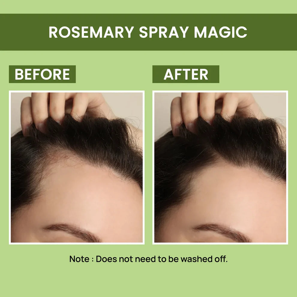 Rosemary Water, Hair Spray For Regrowth (Buy 1 Get 1 Free) | 4.5⭐⭐⭐⭐⭐