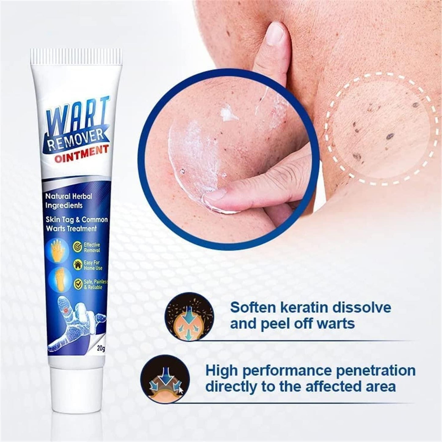 Atemporal  Warts Remover Cream